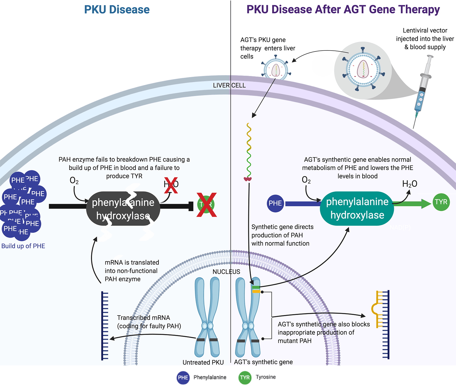 How AGT's PKU gene therapy works