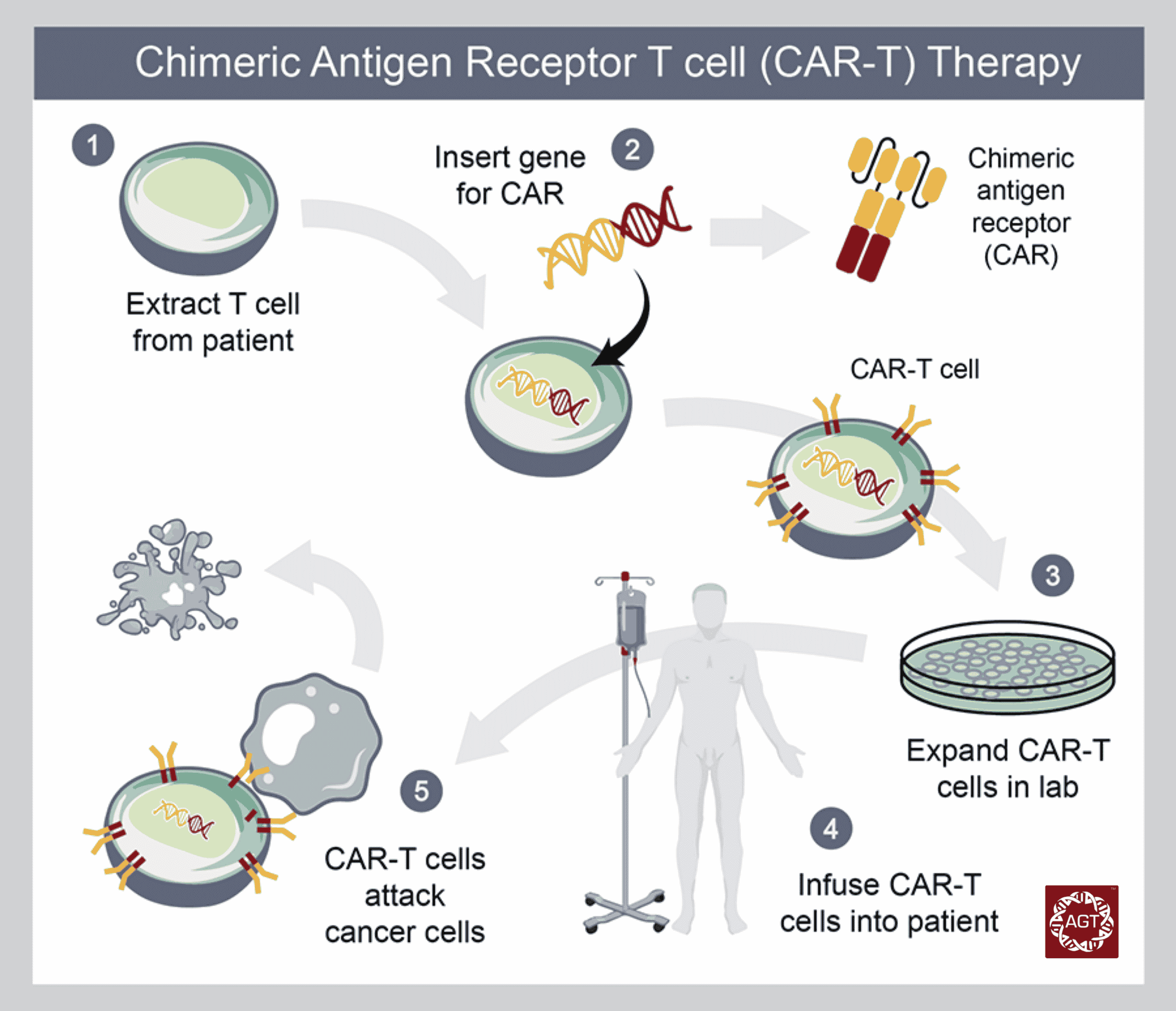 chimeric-Antigen chimeric-Antigen