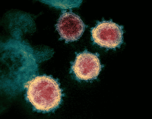 Electron Micrograph of SARS-CoV-2 Virions