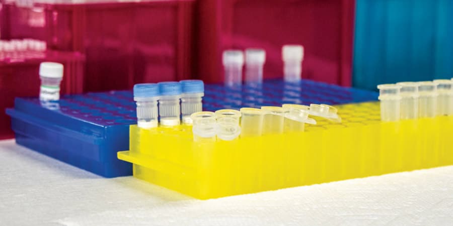 agt-lab-on-the-cusp-of-a-cure Lab samples