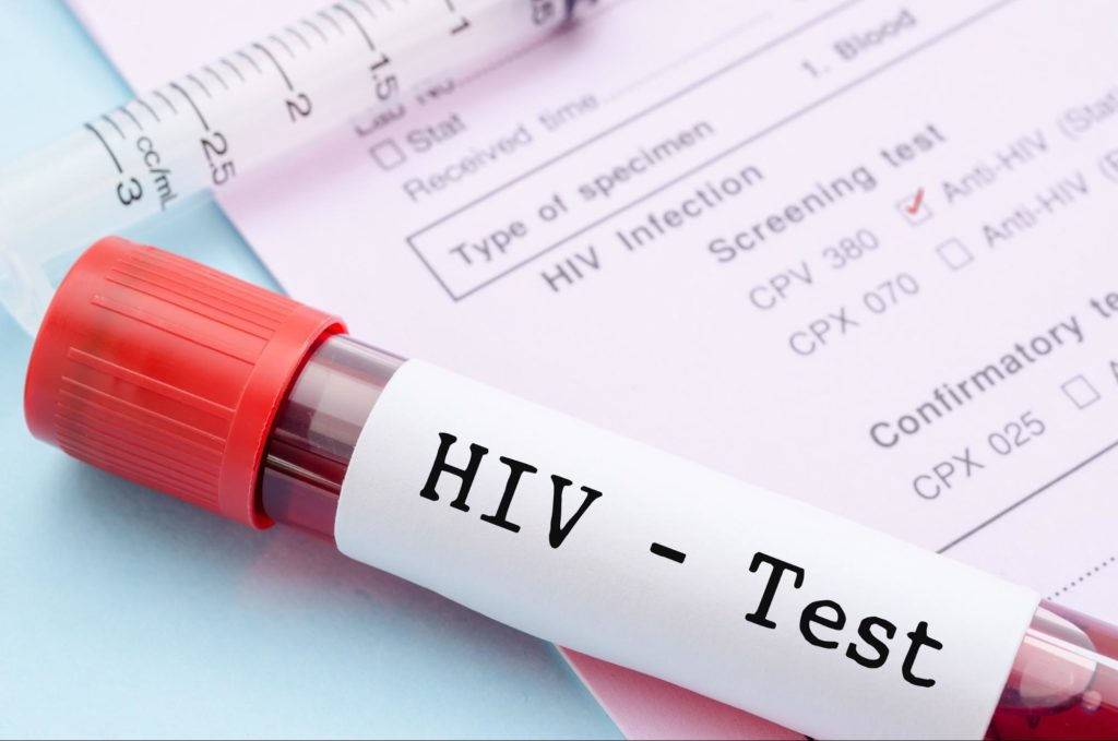 HIV test