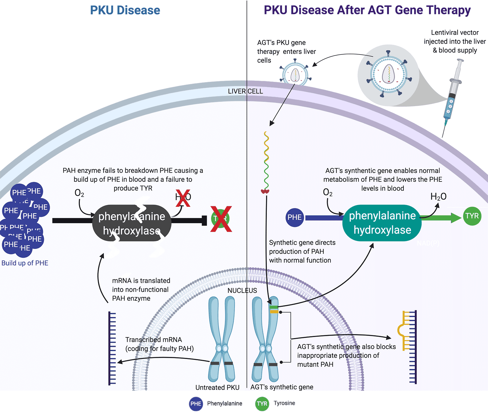 A before and after diagram of PKU affecting someone and then someone receiving AGT's gene therapy for PKU