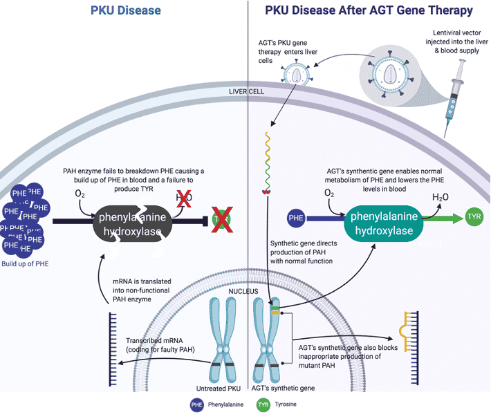 PKU gene therapy treatment