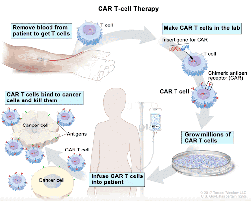 How CAR T-cell therapy works