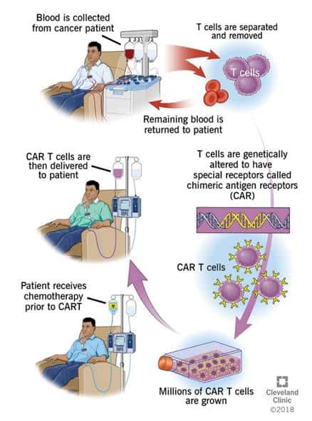 CAR-T Cell Processing