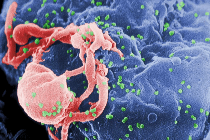 HIV (in green) on an immune cell