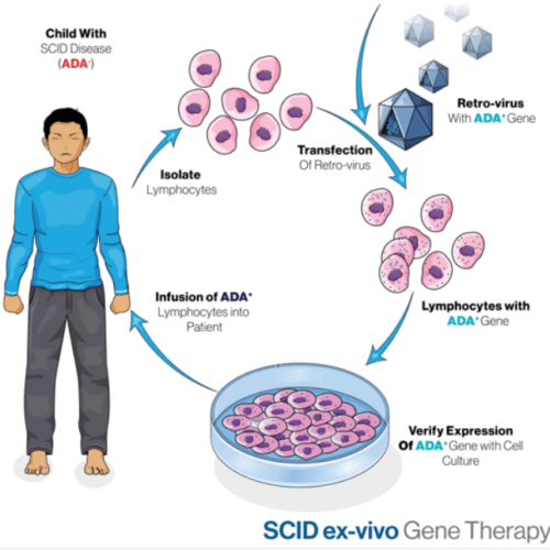 Gene therapy treatment for SCID