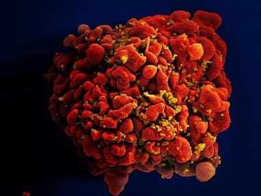 HIV-NIAID-20230328-tcell HIV-NIAID-20230328-tcell