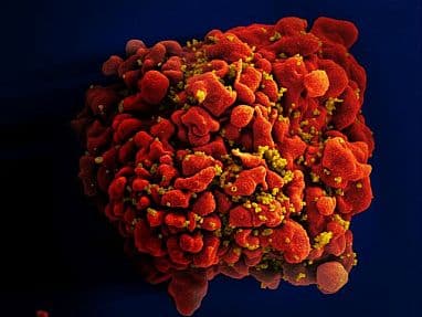 HIV-NIAID-20230328-tcell